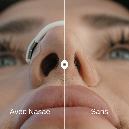 Bande Magnétique - Nasae™